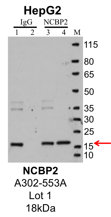 HepG2_GeneTex_GTX115648_40310_NCBP2.png<br>Caption: IP-Western Blot analysis of HepG2 whole cell lysate using NCBP2 specific antibody. Lane 1 is 1% of twenty million whole cell lysate input and lane 2 is 10% of IP enrichment using rabbit normal IgG (lanes under 'IgG'). Lane 3 is 1% of twenty million whole cell lysate input and lane 4 is 10% IP enrichment using rabbit polyclonal anti-NCBP2 antibody (lanes under 'NCBP2').