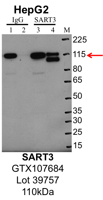 HepG2_Genetex_GT107684_39757_SART3.png<br>Caption: IP-Western Blot analysis of HepG2 whole cell lysate using SART3 specific antibody. Lane 1 is 1% of twenty million whole cell lysate input and lane 2 is 25% of IP enrichment using rabbit normal IgG (lanes under 'IgG'). Lane 3 is 1% of twenty million whole cell lysate input and lane 4 is 10% IP enrichment using rabbit polyclonal anti-SART3 antibody (lanes under 'SART3').