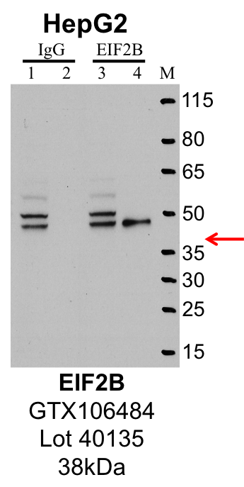 HepG2_Genetex_GTX106484_40135_EIF2B.png<br>Caption: IP-Western Blot analysis of HepG2 whole cell lysate using EIF2S2 specific antibody. Lane 1 is 1% of twenty million whole cell lysate input and lane 2 is 25% of IP enrichment using rabbit normal IgG (lanes under 'IgG'). Lane 3 is 1% of twenty million whole cell lysate input and lane 4 is 10% IP enrichment using rabbit polyclonal anti-EIF2S2 antibody (lanes under 'EIF2S2').