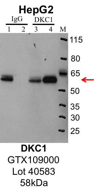 HepG2_Genetex_GTX109000_40583_DKC1.png<br>Caption: IP-Western Blot analysis of HepG2 whole cell lysate using DKC1 specific antibody. Lane 1 is 1% of twenty million whole cell lysate input and lane 2 is 25% of IP enrichment using rabbit normal IgG (lanes under 'IgG'). Lane 3 is 1% of twenty million whole cell lysate input and lane 4 is 10% IP enrichment using rabbit polyclonal anti-DKC1 antibody (lanes under 'DKC1').