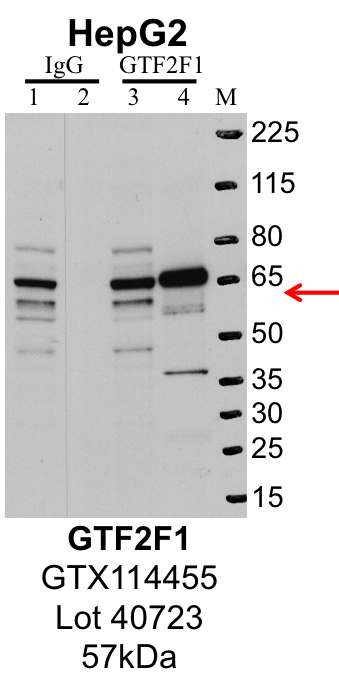 HepG2_Genetex_GTX114455_40723_GTF2F1.png<br>Caption: IP-Western Blot analysis of HepG2 whole cell lysate using GTF2F1 specific antibody. Lane 1 is 1% of twenty million whole cell lysate input and lane 2 is 25% of IP enrichment using rabbit normal IgG (lanes under 'IgG'). Lane 3 is 1% of twenty million whole cell lysate input and lane 4 is 10% IP enrichment using rabbit polyclonal anti-GTF2F1 antibody (lanes under 'GTF2F1').