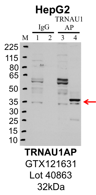 HepG2_Genetex_GTX121631_40863_TRNAU1AP.png<br>Caption: IP-Western Blot analysis of HepG2 whole cell lysate using TRNAU1AP specific antibody. Lane 1 is 1% of twenty million whole cell lysate input and lane 2 is 25% of IP enrichment using rabbit normal IgG (lanes under 'IgG'). Lane 3 is 1% of twenty million whole cell lysate input and lane 4 is 10% IP enrichment using rabbit polyclonal anti-TRNAU1AP antibody (lanes under 'TRNAU1AP').