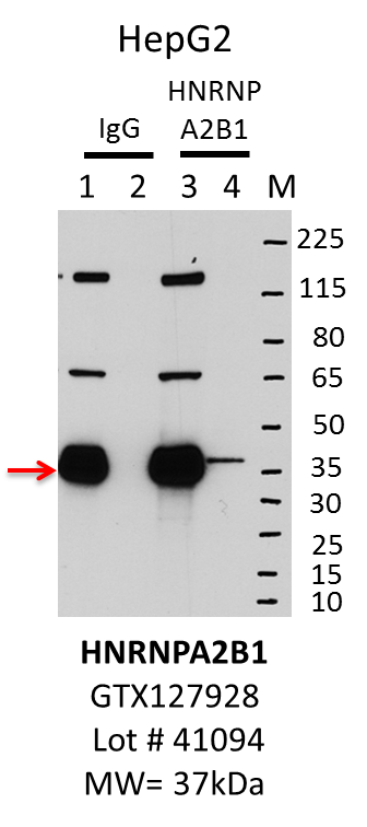 HepG2_Genetex_GTX127928_41094_HNRNPA2B1.png<br>Caption: IP-Western Blot analysis of HepG2 whole cell lysate using HNRNPA2B1 specific antibody. Lane 1 is 1% of twenty million whole cell lysate input and lane 2 is 10% of IP enrichment using rabbit normal IgG (lanes under 'IgG'). Lane 3 is 1% of twenty million whole cell lysate input and lane 4 is 10% IP enrichment using rabbit polyclonal hnRNP A2B1 antibody (lanes under 'HNRNPA2B1').