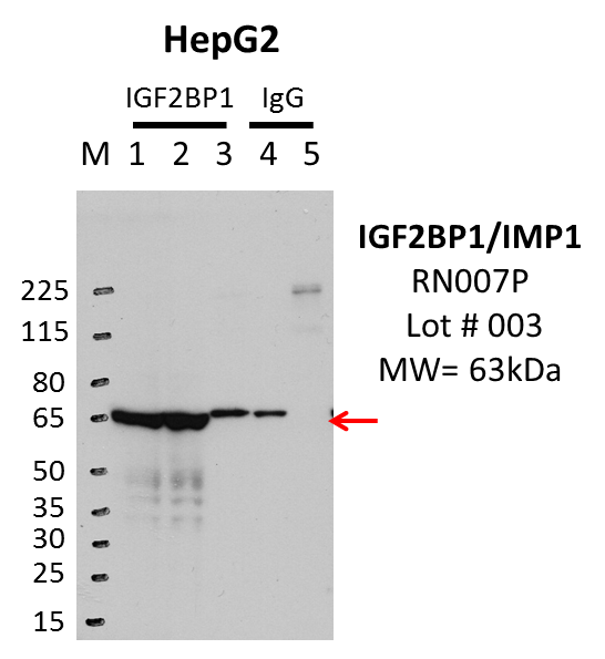 HepG2_MBLI_RN007P_003_IGF2BP1.png<br>Caption: IP-WB analysis of HepG2 whole cell lysate using IGF2BP1 specific antibody. Lane 1 is 1% twenty million whole cell lysate input, lane 2 is 1% of the supernatant afer IP and Lane 3 is 10% of IP enrichment using rabbit polyclonal anti-IGF2BP1 Antibody. Lane 4 is 1% ten million whole cell lysate input and lane 5 is 25% IP enrichment using rabbit normal IgG (lanes under 'IgG').