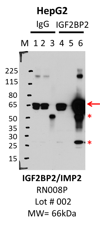 HepG2_MBLI_RN008P_002_IGF2BP2.png<br>Caption: IP-Western Blot analysis of HepG2 whole cell lysate using IGF2BP2 specific antibody. Lane 1 is 2.5% of five million whole cell lysate input, lane 2 is 2.5% of supernatant after immunoprecipitation and Lane 3 is 50% of IP enrichment using either rabbit polyclonal anti-IGF2BP2 antibody (lanes under 'IGF2BP2') or using rabbit normal IgG (lanes under 'IgG'). Stars indicate light and heavy chains of IgG background