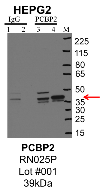 HepG2_MBLI_RN025P_001_PCBP2.png<br>Caption: IP-Western Blot analysis of HepG2 whole cell lysate using PCBP2 specific antibody. Lane 1 is 1% of twenty million whole cell lysate input and lane 2 is 25% of IP enrichment using rabbit normal IgG (lanes under 'IgG'). Lane 3 is 1% of twenty million whole cell lysate input and lane 4 is 10% IP enrichment using rabbit polyclonal anti-PCBP2 antibody (lanes under 'PCBP2').