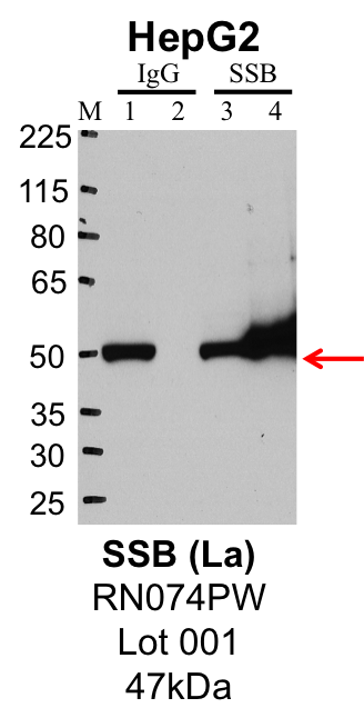 HepG2_MBLI_RN074PW_001_SSB.png<br>Caption: IP-Western Blot analysis of HepG2 whole cell lysate using SSB specific antibody. Lane 1 is 1% of twenty million whole cell lysate input and lane 2 is 25% of IP enrichment using rabbit normal IgG (lanes under 'IgG'). Lane 3 is 1% of twenty million whole cell lysate input and lane 4 is 10% IP enrichment using rabbit polyclonal anti-SSB antibody (lanes under 'SSB').