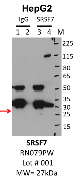 HepG2_MBLI_RN079PW_001_SRSF7.png<br>Caption: IP-Western Blot analysis of HepG2 whole cell lysate using SRSF7 specific antibody. Lane 1 is 1% of twenty million whole cell lysate input and lane 2 is 25% of IP enrichment using rabbit normal IgG (lanes under 'IgG'). Lane 3 is 1% of twenty million whole cell lysate input and lane 4 is 10% IP enrichment using rabbit polyclonal anti-SRSF7 antibody (lanes under 'SRSF7').