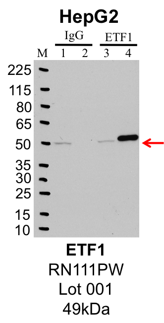 HepG2_MBLI_RN111PW_001_ETF1.png<br>Caption: IP-Western Blot analysis of HepG2 whole cell lysate using ETF1 specific antibody. Lane 1 is 1% of twenty million whole cell lysate input and lane 2 is 25% of IP enrichment using rabbit normal IgG (lanes under 'IgG'). Lane 3 is 1% of twenty million whole cell lysate input and lane 4 is 10% IP enrichment using rabbit polyclonal anti-ETF1 antibody (lanes under 'ETF1').