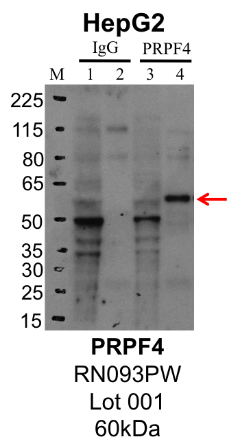 HepG2_MBL_RN093PW_001_PRPF4.png<br>Caption: IP-Western Blot analysis of HepG2 whole cell lysate using PRPF4 specific antibody. Lane 1 is 1% of twenty million whole cell lysate input and lane 2 is 25% of IP enrichment using rabbit normal IgG (lanes under 'IgG'). Lane 3 is 1% of twenty million whole cell lysate input and lane 4 is 10% IP enrichment using rabbit polyclonal anti-PRPF4 antibody (lanes under 'PRPF4').