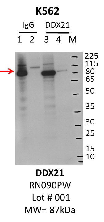 K5622_MBLI_RN090PW_001_DDX21.png<br>Caption: IP-Western Blot analysis of K562 whole cell lysate using DDX21 specific antibody. Lane 1 is 1% of twenty million whole cell lysate input and lane 2 is 10% of IP enrichment using rabbit normal IgG (lanes under 'IgG'). Lane 3 is 1% of twenty million whole cell lysate input and lane 4 is 10% IP enrichment using rabbit polyclonal anti-DDX21 antibody (lanes under 'DDX21').