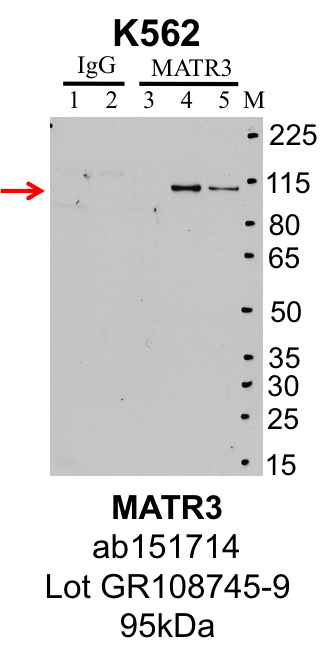 K562_Abcam_ab151714_GR108745-9_MATR3.png<br>Caption: IP-Western Blot analysis of K562 whole cell lysate using MATR3 specific antibody. Lane 1 is 1% of twenty million whole cell lysate input and lane 2 is 10% of IP enrichment using rabbit normal IgG (lanes under 'IgG'). Lane 3 is 1% of twenty million whole cell lysate input and lanes 4 and 5 are 10% IP enrichment of biological replicates using rabbit polyclonal MATR3 antibody (lanes under 'MATR3').