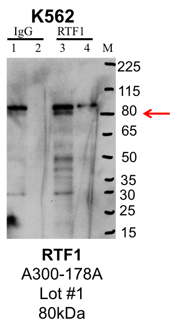 K562_Bethyl_A300-178A_1_RTF1.png<br>Caption: IP-Western Blot analysis of K562 whole cell lysate using RTF1 specific antibody. Lane 1 is 1% of twenty million whole cell lysate input and lane 2 is 25% of IP enrichment using rabbit normal IgG (lanes under 'IgG'). Lane 3 is 1% of twenty million whole cell lysate input and lane 4 is 10% IP enrichment using rabbit polyclonal anti-RTF1 antibody (lanes under 'RTF1').