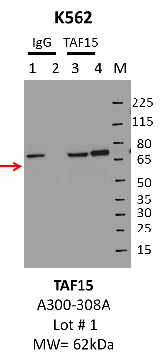 K562_Bethyl_A300-308A_1_TAF15.png<br>Caption: IP-Western Blot analysis of K562 whole cell lysate using TAF15 specific antibody. Lane 1 is 1% of twenty million whole cell lysate input and lane 2 is 10% of IP enrichment using rabbit normal IgG (lanes under 'IgG'). Lane 3 is 1% of twenty million whole cell lysate input and lane 4 is 10% IP enrichment using rabbit polyclonal anti-TAF15 antibody (lanes under 'TAF15').