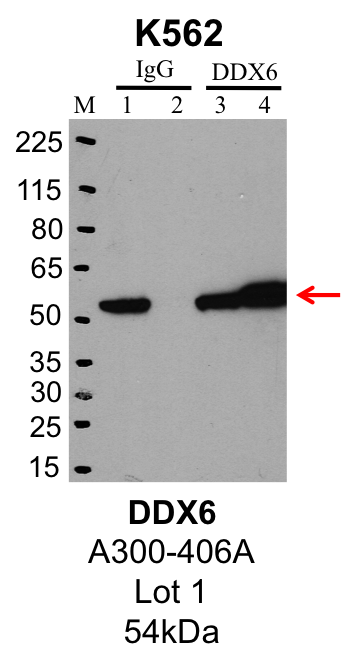 K562_Bethyl_A300-406A_1_DDX6.png<br>Caption: IP-Western Blot analysis of K562 whole cell lysate using DDX6 specific antibody. Lane 1 is 1% of twenty million whole cell lysate input and lane 2 is 25% of IP enrichment using rabbit normal IgG (lanes under 'IgG'). Lane 3 is 1% of twenty million whole cell lysate input and lane 4 is 10% IP enrichment using rabbit polyclonal anti-DDX6 antibody (lanes under 'DDX6').