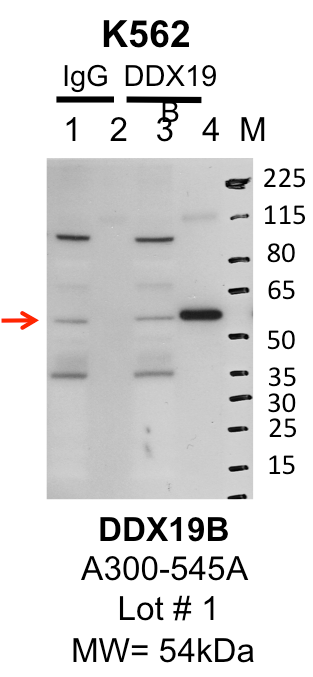 K562_Bethyl_A300-545A_1_DDX19B.png<br>Caption: IP-Western Blot analysis of K562 whole cell lysate using DDX19B specific antibody. Lane 1 is 1% of twenty million whole cell lysate input and lane 2 is 25% of IP enrichment using rabbit normal IgG (lanes under 'IgG'). Lane 3 is 1% of twenty million whole cell lysate input and lane 4 is 10% IP enrichment using rabbit polyclonal anti-DDX19B antibody (lanes under 'DDX19B').