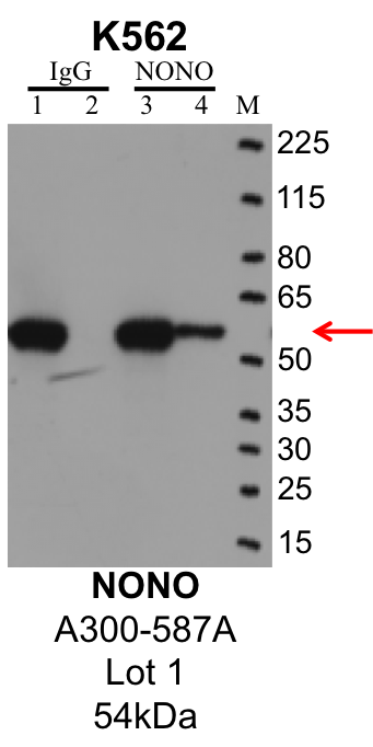 K562_Bethyl_A300-587A_1_NONO.png<br>Caption: IP-Western Blot analysis of K562 whole cell lysate using NONO specific antibody. Lane 1 is 1% of twenty million whole cell lysate input and lane 2 is 25% of IP enrichment using rabbit normal IgG (lanes under 'IgG'). Lane 3 is 1% of twenty million whole cell lysate input and lane 4 is 10% IP enrichment using rabbit polyclonal anti-NONO antibody (lanes under 'NONO').