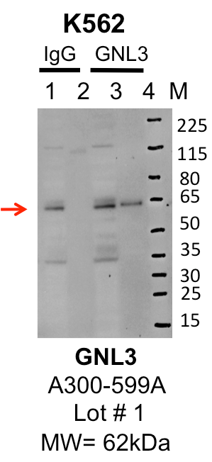 K562_Bethyl_A300-599A_1_GNL3.png<br>Caption: IP-Western Blot analysis of K562 whole cell lysate using GNL3 specific antibody. Lane 1 is 1% of twenty million whole cell lysate input and lane 2 is 25% of IP enrichment using rabbit normal IgG (lanes under 'IgG'). Lane 3 is 1% of twenty million whole cell lysate input and lane 4 is 10% IP enrichment using rabbit polyclonal anti-GNL3 antibody (lanes under 'GNL3').