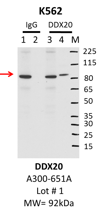 K562_Bethyl_A300-651A_1_DDX20.png<br>Caption: IP-WB characterization of DDX20 specific antibody in K562 cell line . Lane 1 is 2.5% of five million K562 whole cell lysate Input, lane 2 is 2.5% of supernatant after immunoprecipitation and Lane 3 is 50% of IP enrichment using rabbit polyclonal DDX20 Antibody. Lane 4 is the immunoprecipitation of DDX20 antibody in K562 lysate. This antibody passes preliminary validation and will be further pursued for primary and secondary validation.