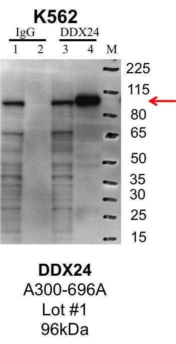 K562_Bethyl_A300-696A_1_DDX24.png<br>Caption: IP-Western Blot analysis of K562 whole cell lysate using DDX24 specific antibody. Lane 1 is 1% of twenty million whole cell lysate input and lane 2 is 25% of IP enrichment using rabbit normal IgG (lanes under 'IgG'). Lane 3 is 1% of twenty million whole cell lysate input and lane 4 is 10% IP enrichment using rabbit polyclonal anti-DDX24 antibody (lanes under 'DDX24').