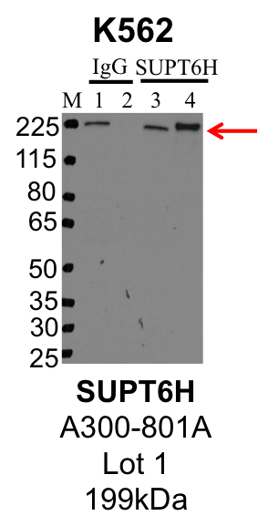 K562_Bethyl_A300-801A_1_SUPT6H.png<br>Caption: IP-Western Blot analysis of a K562 whole cell lysate using SUPT6H specific antibody. Lane 1 is 1% of twenty million whole cell lysate input and lane 2 is 25% of IP enrichment using rabbit normal IgG (lanes under 'IgG'). Lane 3 is 1% of twenty million whole cell lysate input and lane 4 is 10% IP enrichment using rabbit polyclonal anti-SUPT6H antibody (lanes under 'SUPT6H').