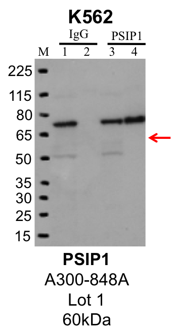 K562_Bethyl_A300-848A_1_PSIP1.png<br>Caption: IP-Western Blot analysis of K562 whole cell lysate using PSIP1 specific antibody. Lane 1 is 1% of twenty million whole cell lysate input and lane 2 is 25% of IP enrichment using rabbit normal IgG (lanes under 'IgG'). Lane 3 is 1% of twenty million whole cell lysate input and lane 4 is 10% IP enrichment using rabbit polyclonal anti-PSIP1 antibody (lanes under 'PSIP1').