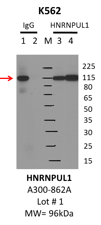 K562_Bethyl_A300-862A_1_hnRNPUL1.png<br>Caption: IP-Western Blot analysis of K562 whole cell lysate using HNRNPUL1 specific antibody. Lane 1 is 1% of twenty million whole cell lysate input and lane 2 is 10% of IP enrichment using rabbit normal IgG (lanes under 'IgG'). Lane 3 is 1% of twenty million whole cell lysate input and lane 4 is 10% IP enrichment using rabbit polyclonal anti-HNRNPUL1 antibody (lanes under 'HNRNPUL1').