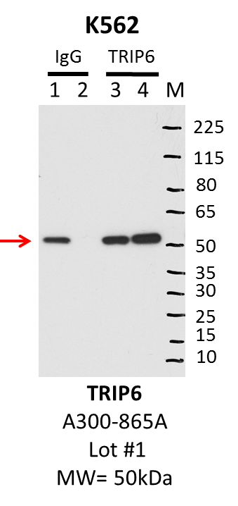 K562_Bethyl_A300-865A_1_TRIP6.png<br>Caption: IP-Western Blot analysis of K562 whole cell lysate using TRIP6 specific antibody. Lane 1 is 1% of twenty million whole cell lysate input and lane 2 is 10% of IP enrichment using rabbit normal IgG (lanes under 'IgG'). Lane 3 is 1% of twenty million whole cell lysate input and lane 4 is 10% IP enrichment using rabbit polyclonal anti-TRIP6 antibody (lanes under 'TRIP6').