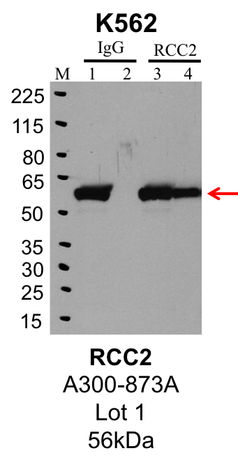 K562_Bethyl_A300-873A_1_RCC2.png<br>Caption: IP-Western Blot analysis of K562 whole cell lysate using RCC2 specific antibody. Lane 1 is 1% of twenty million whole cell lysate input and lane 2 is 25% of IP enrichment using rabbit normal IgG (lanes under 'IgG'). Lane 3 is 1% of twenty million whole cell lysate input and lane 4 is 10% IP enrichment using rabbit polyclonal anti-RCC2 antibody (lanes under 'RCC2').