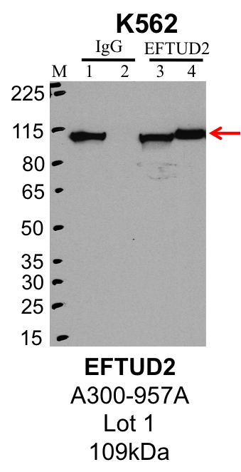 K562_Bethyl_A300-957A_1_EFTUD2.png<br>Caption: IP-Western Blot analysis of K562 whole cell lysate using EFTUD2 specific antibody. Lane 1 is 1% of twenty million whole cell lysate input and lane 2 is 25% of IP enrichment using rabbit normal IgG (lanes under 'IgG'). Lane 3 is 1% of twenty million whole cell lysate input and lane 4 is 10% IP enrichment using rabbit polyclonal anti-EFTUD2 antibody (lanes under 'EFTUD2').