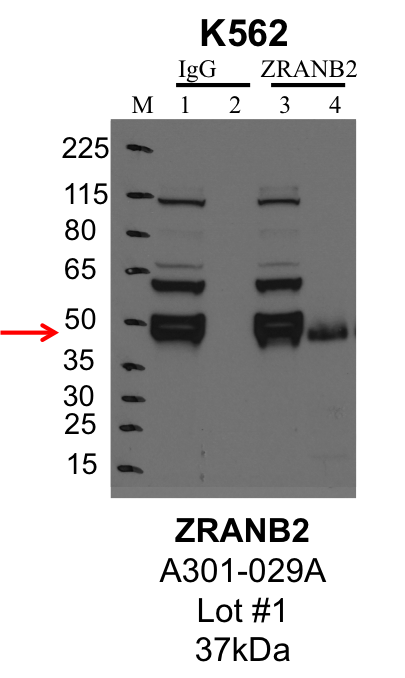 K562_Bethyl_A301-029A_1_ZRANB2.png<br>Caption: IP-Western Blot analysis of K562 whole cell lysate using ZRANB2 specific antibody. Lane 1 is 1% of twenty million whole cell lysate input and lane 2 is 25% of IP enrichment using rabbit normal IgG (lanes under 'IgG'). Lane 3 is 1% of twenty million whole cell lysate input and lane 4 is 10% IP enrichment using rabbit polyclonal anti-ZRANB2 antibody (lanes under 'ZRANB2').