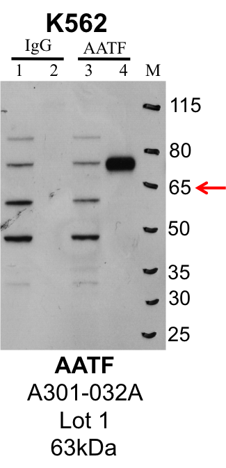 K562_Bethyl_A301-032A_1_AATF.png<br>Caption: IP-Western Blot analysis of K562 whole cell lysate using AATF specific antibody. Lane 1 is 1% of twenty million whole cell lysate input and lane 2 is 25% of IP enrichment using rabbit normal IgG (lanes under 'IgG'). Lane 3 is 1% of twenty million whole cell lysate input and lane 4 is 10% IP enrichment using rabbit polyclonal anti-AATF antibody (lanes under 'AATF').