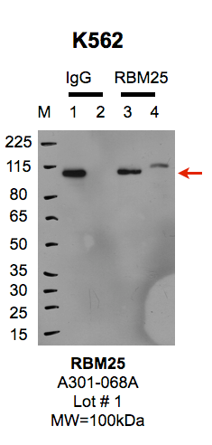 K562_Bethyl_A301-068A_1_RBM25.png<br>Caption: IP-Western Blot analysis of K562 whole cell lysate using RBM25 specific antibody. Lane 1 is 1% of twenty million whole cell lysate input and lane 2 is 25% of IP enrichment using rabbit normal IgG (lanes under 'IgG'). Lane 3 is 1% of twenty million whole cell lysate input and lane 4 is 10% IP enrichment using rabbit polyclonal anti-RBM25 antibody (lanes under 'RBM25').