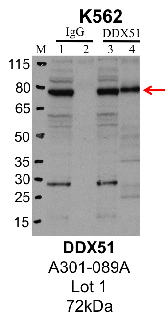 K562_Bethyl_A301-089A_1_DDX51.png<br>Caption: IP-Western Blot analysis of K562 whole cell lysate using DDX51 specific antibody. Lane 1 is 1% of twenty million whole cell lysate input and lane 2 is 25% of IP enrichment using rabbit normal IgG (lanes under 'IgG'). Lane 3 is 1% of twenty million whole cell lysate input and lane 4 is 10% IP enrichment using rabbit polyclonal anti-DDX51 antibody (lanes under 'DDX51').