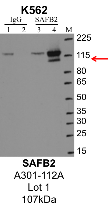 K562_Bethyl_A301-112_1_SAFB2.png<br>Caption: IP-Western Blot analysis of K562 whole cell lysate using SAFB2 specific antibody. Lane 1 is 1% of twenty million whole cell lysate input and lane 2 is 25% of IP enrichment using rabbit normal IgG (lanes under 'IgG'). Lane 3 is 1% of twenty million whole cell lysate input and lane 4 is 10% IP enrichment using rabbit polyclonal anti-SAFB2 antibody (lanes under 'SAFB2').