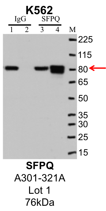 K562_Bethyl_A301-321A_1_SFPQ.png<br>Caption: IP-Western Blot analysis of K562 whole cell lysate using SFPQ specific antibody. Lane 1 is 1% of twenty million whole cell lysate input and lane 2 is 25% of IP enrichment using rabbit normal IgG (lanes under 'IgG'). Lane 3 is 1% of twenty million whole cell lysate input and lane 4 is 10% IP enrichment using rabbit polyclonal anti-SFPQ antibody (lanes under 'SFPQ').