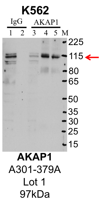 K562_Bethyl_A301-379A_1_AKAP1.png<br>Caption: IP-Western Blot analysis of K562 whole cell lysate using AKAP1 specific antibody. Lane 1 is 1% of twenty million whole cell lysate input and lane 2 is 25% of IP enrichment using rabbit normal IgG (lanes under 'IgG'). Lane 3 is 1% of twenty million whole cell lysate input and lanes 4 and 5 are 10% IP enrichment from biological replicates using rabbit polyclonal anti-AKAP1 antibody (lanes under 'AKAP1').