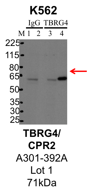 K562_Bethyl_A301-392A_1_TBRG4.png<br>Caption: IP-Western Blot analysis of K562 whole cell lysate using TBRG4 specific antibody. Lane 1 is 1% of twenty million whole cell lysate input and lane 2 is 25% of IP enrichment using rabbit normal IgG (lanes under 'IgG'). Lane 3 is 1% of twenty million whole cell lysate input and lane 4 is 10% IP enrichment using rabbit polyclonal anti-TBRG4 antibody (lanes under 'TBRG4').