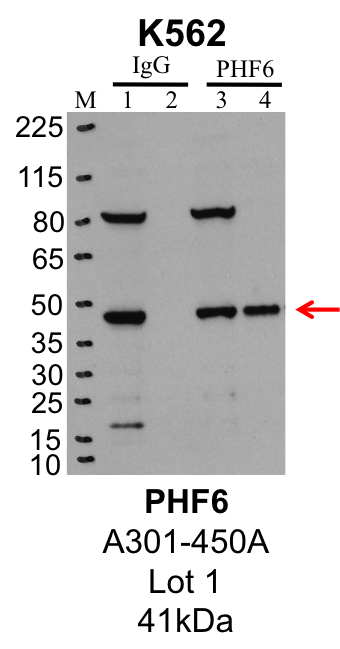 K562_Bethyl_A301-450A_1_PHF6.png<br>Caption: IP-Western Blot analysis of K562 whole cell lysate using PHF6 specific antibody. Lane 1 is 1% of twenty million whole cell lysate input and lane 2 is 25% of IP enrichment using rabbit normal IgG (lanes under 'IgG'). Lane 3 is 1% of twenty million whole cell lysate input and lane 4 is 10% IP enrichment using rabbit polyclonal anti-PHF6 antibody (lanes under 'PHF6').