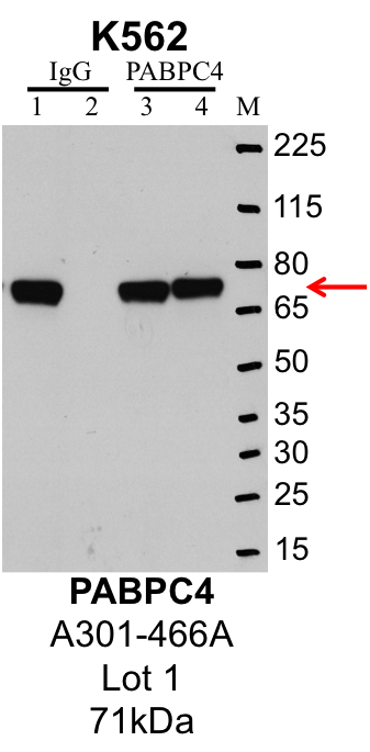 K562_Bethyl_A301-466A_1_PABPC4.png<br>Caption: IP-Western Blot analysis of K562 whole cell lysate using PABPC4 specific antibody. Lane 1 is 1% of twenty million whole cell lysate input and lane 2 is 25% of IP enrichment using rabbit normal IgG (lanes under 'IgG'). Lane 3 is 1% of twenty million whole cell lysate input and lane 4 is 10% IP enrichment using rabbit polyclonal anti-PABPC4 antibody (lanes under 'PABPC4').