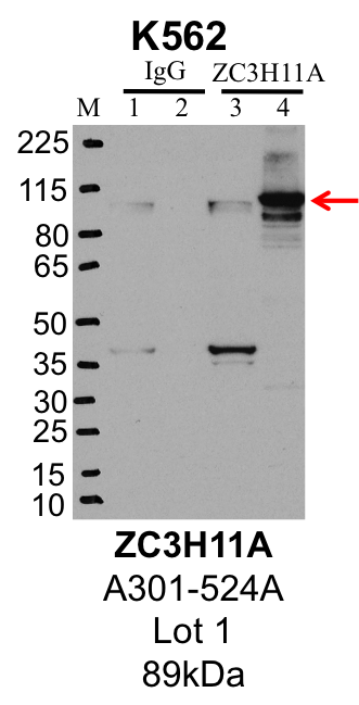 K562_Bethyl_A301-524A_1_ZC3H11A.png<br>Caption: IP-Western Blot analysis of K562 whole cell lysate using ZC3H11A specific antibody. Lane 1 is 1% of twenty million whole cell lysate input and lane 2 is 25% of IP enrichment using rabbit normal IgG (lanes under 'IgG'). Lane 3 is 1% of twenty million whole cell lysate input and lane 4 is 10% IP enrichment using rabbit polyclonal anti-ZC3H11A antibody (lanes under 'ZC3H11A').