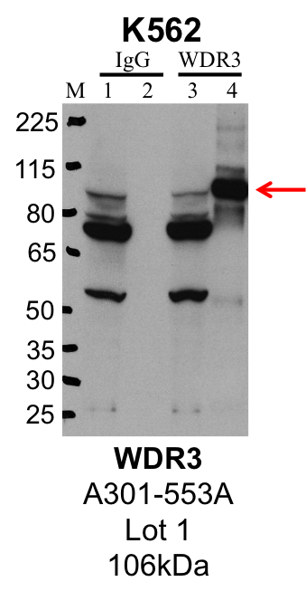 K562_Bethyl_A301-553A_1_WDR3.png<br>Caption: IP-Western Blot analysis of K562 whole cell lysate using WDR3 specific antibody. Lane 1 is 1% of twenty million whole cell lysate input and lane 2 is 25% of IP enrichment using rabbit normal IgG (lanes under 'IgG'). Lane 3 is 1% of twenty million whole cell lysate input and lane 4 is 10% IP enrichment using rabbit polyclonal anti-WDR3 antibody (lanes under 'WDR3').