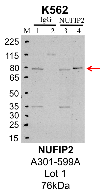 K562_Bethyl_A301-599A_1_NUFIP2.png<br>Caption: IP-Western Blot analysis of K562 whole cell lysate using NUFIP2 specific antibody. Lane 1 is 1% of twenty million whole cell lysate input and lane 2 is 25% of IP enrichment using rabbit normal IgG (lanes under 'IgG'). Lane 3 is 1% of twenty million whole cell lysate input and lane 4 is 10% IP enrichment using rabbit polyclonal anti-NUFIP2 antibody (lanes under 'NUFIP2').