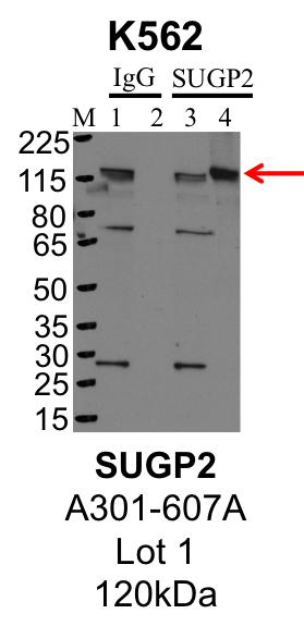 K562_Bethyl_A301-607A_1_SUGP2.png<br>Caption: IP-Western Blot analysis of K562 whole cell lysate using SUGP2 specific antibody. Lane 1 is 1% of twenty million whole cell lysate input and lane 2 is 25% of IP enrichment using rabbit normal IgG (lanes under 'IgG'). Lane 3 is 1% of twenty million whole cell lysate input and lane 4 is 10% IP enrichment using rabbit polyclonal anti-SUGP2 antibody (lanes under 'SUGP2').