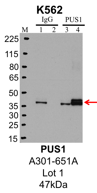 K562_Bethyl_A301-651A_1_PUS1.png<br>Caption: IP-Western Blot analysis of K562 whole cell lysate using PUS1 specific antibody. Lane 1 is 1% of twenty million whole cell lysate input and lane 2 is 25% of IP enrichment using rabbit normal IgG (lanes under 'IgG'). Lane 3 is 1% of twenty million whole cell lysate input and lane 4 is 10% IP enrichment using rabbit polyclonal anti-PUS1 antibody (lanes under 'PUS1').