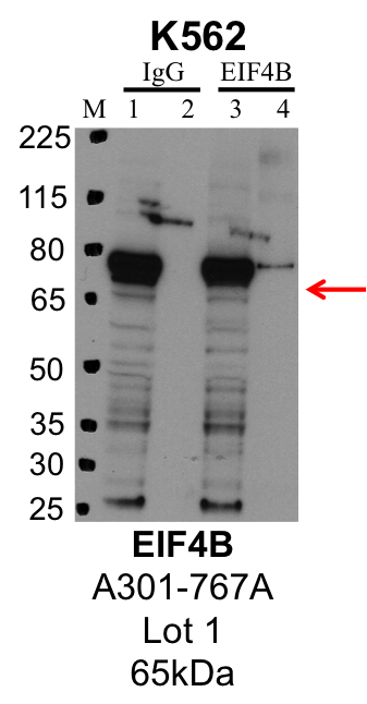 K562_Bethyl_A301-767A_1_EIF4B.png<br>Caption: IP-Western Blot analysis of K562 whole cell lysate using EIF4B specific antibody. Lane 1 is 1% of twenty million whole cell lysate input and lane 2 is 25% of IP enrichment using rabbit normal IgG (lanes under 'IgG'). Lane 3 is 1% of twenty million whole cell lysate input and lane 4 is 10% IP enrichment using rabbit polyclonal anti-EIF4B antibody (lanes under 'EIF4B').