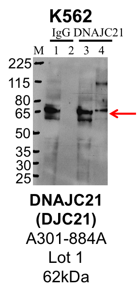 K562_Bethyl_A301-884A_1_DNAJC21.png<br>Caption: IP-Western Blot analysis of K562 whole cell lysate using DNAJC21 specific antibody. Lane 1 is 1% of twenty million whole cell lysate input and lane 2 is 25% of IP enrichment using rabbit normal IgG (lanes under 'IgG'). Lane 3 is 1% of twenty million whole cell lysate input and lane 4 is 10% IP enrichment using rabbit polyclonal anti-DNAJC21 antibody (lanes under 'DNAJC21').