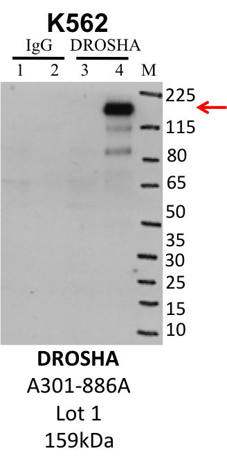 K562_Bethyl_A301-886A_1_DROSHA.png<br>Caption: IP-Western Blot analysis of K562 whole cell lysate using DROSHA specific antibody. Lane 1 is 1% of twenty million whole cell lysate input and lane 2 is 10% of IP enrichment using rabbit normal IgG (lanes under 'IgG'). Lane 3 is 1% of twenty million whole cell lysate input and lane 4 is 10% IP enrichment using rabbit polyclonal anti-DROSHA antibody (lanes under 'DROSHA').