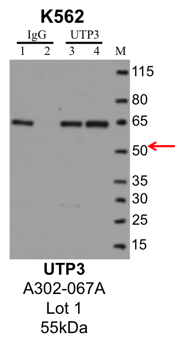 K562_Bethyl_A302-067A_1_UTP3.png<br>Caption: IP-Western Blot analysis of K562 whole cell lysate using UTP3 specific antibody. Lane 1 is 1% of twenty million whole cell lysate input and lane 2 is 10% of IP enrichment using rabbit normal IgG (lanes under 'IgG'). Lane 3 is 1% of twenty million whole cell lysate input and lane 4 is 10% IP enrichment using rabbit polyclonal anti-UTP3 antibody (lanes under 'UTP3').