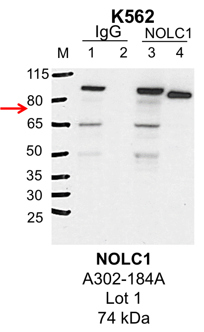 K562_Bethyl_A302-184A_1_NOLC1.png<br>Caption: IP-Western Blot analysis of K562 whole cell lysate using NOLC1 specific antibody. Lane 1 is 1% of twenty million whole cell lysate input and lane 2 is 25% of IP enrichment using rabbit normal IgG (lanes under 'IgG'). Lane 3 is 1% of twenty million whole cell lysate input and lane 4 is 10% IP enrichment using rabbit polyclonal anti-NOLC1 antibody (lanes under 'NOLC1').